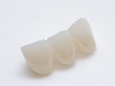 オールセラミック歯