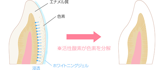 活性酸素が色素を分解イメージ